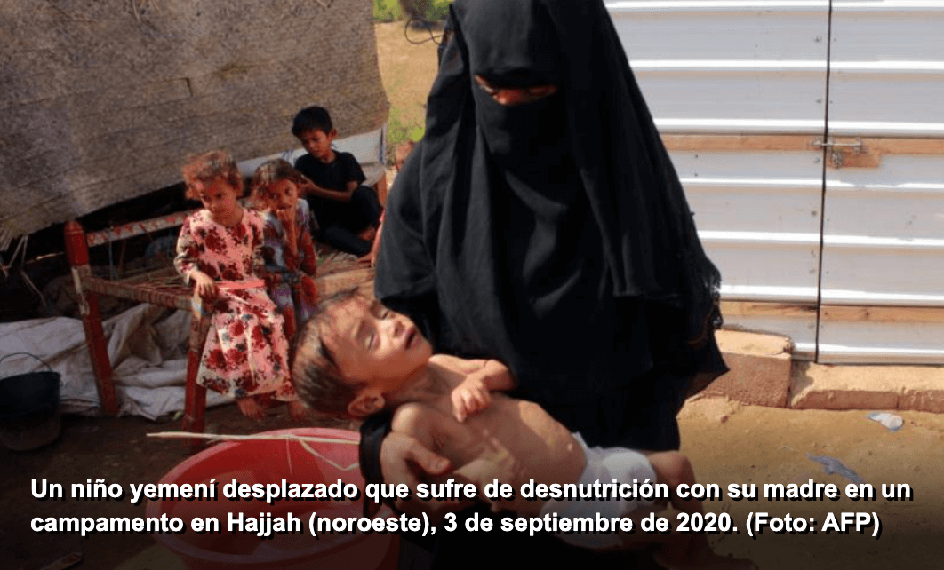 mujeres y niños víctimas de la guerra en Yemen