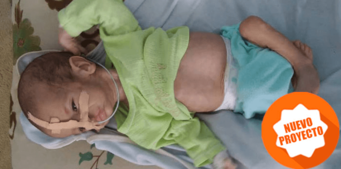 proyecto desnutrición en Yemen de Solidarios sin Fronteras