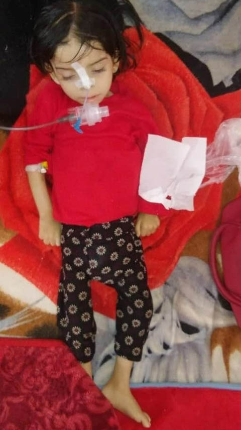 nina-desnutricion-yemen Proyecto desnutrición infantil en Yemen
