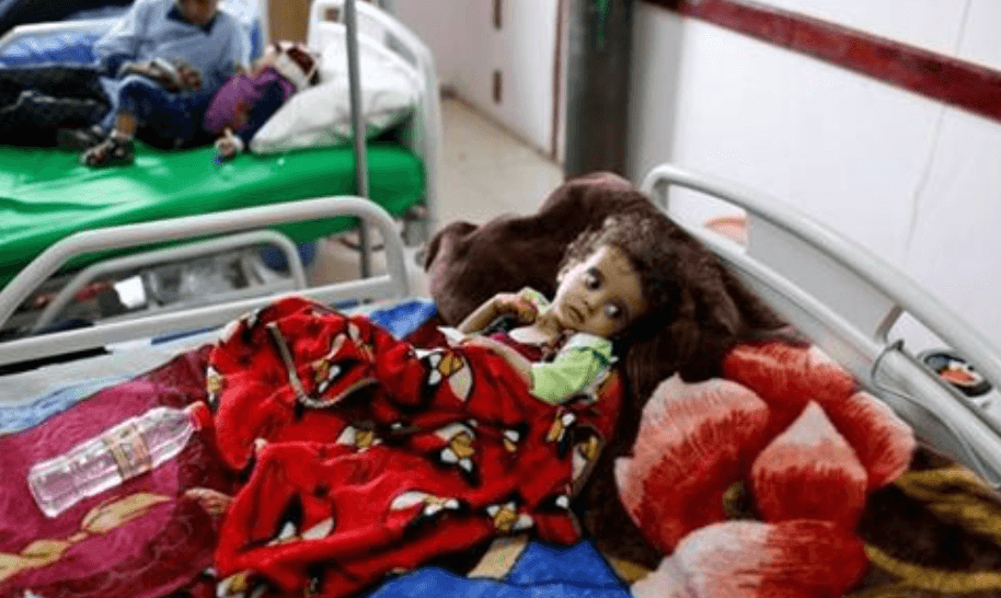Niños enfermos de leucemia mueren en Yemen