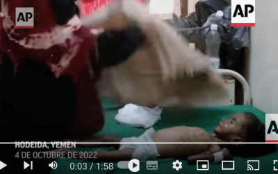 Los niños de Yemen pasan hambre mientras la tregua se tambalea