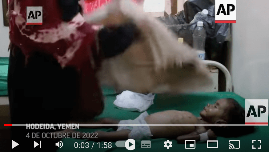 Los niños de Yemen pasan hambre mientras la tregua se tambalea